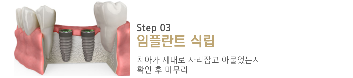 내이튼치과 동탄 치과 진료 이미지