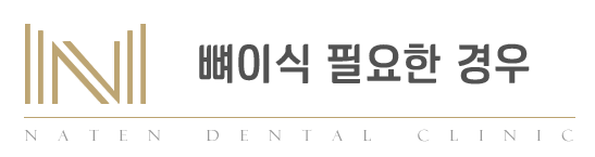 내이튼치과 동탄 치과 진료 이미지