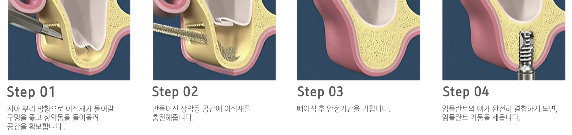 내이튼치과 동탄 치과 진료 이미지