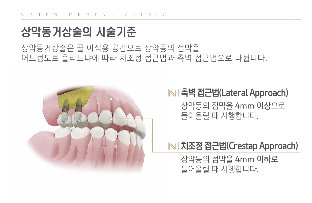 내이튼치과 동탄 치과 진료 이미지